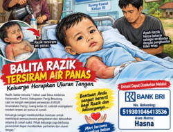 Balita Razik Tersiram Air Panas, Keluarga Harapkan Uluran Tangan